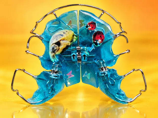 Turquoise with butterfly glitter and a tortoise with a ladybird